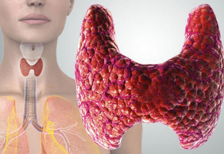 Автоімунний тиреоїдит: як розпізнати атаку імунітету на власну щитовидку та відновити контроль